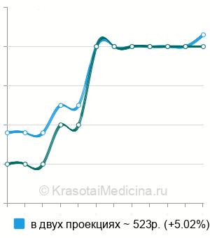 Средняя стоимость рентген грудной клетки в Ставрополе