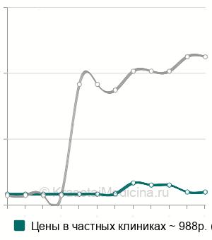 Средняя стоимость рентген поясничного отдела позвоночника в Ставрополе