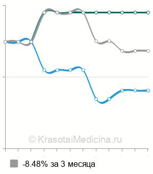 Средняя стоимость КТ сосудов головного мозга в Ставрополе
