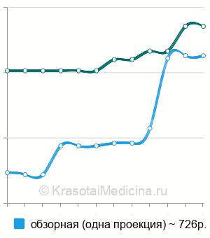 Средняя стоимость рентген легких в Ставрополе