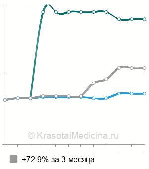Средняя стоимость КТ околоносовых пазух в Ставрополе