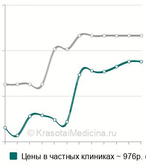Средняя стоимость УЗИ слюнных желез в Ставрополе