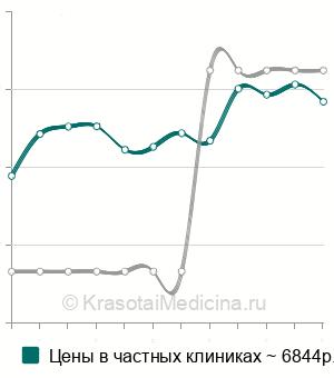 Средняя стоимость удаление ретинированного зуба в Ставрополе