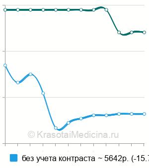 Средняя стоимость МРТ гипофиза в Ставрополе