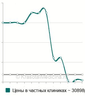 Средняя стоимость лапароскопическая коагуляция маточных труб в Ставрополе